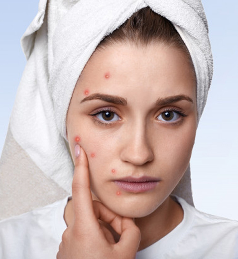 Skin Care, Skin Disorder